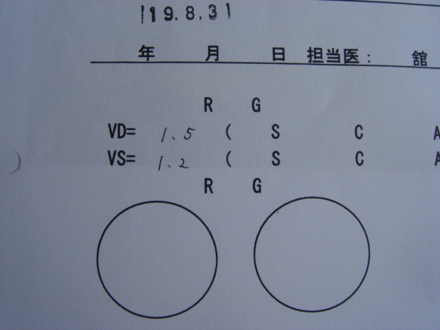 レーシック実体験日記 私の視力回復への道